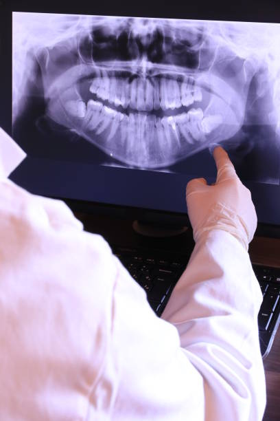 Best Emergency Treatment for Dental Infections or Abscesses in Bowling Green, KY