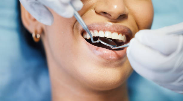 Best Emergency Treatment for Dental Infections or Abscesses in Bowling Green, KY