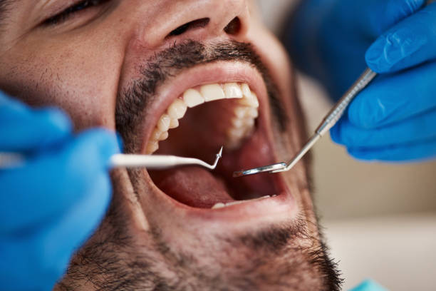 Best Cosmetic Emergency Dentistry in Bowling Green, KY